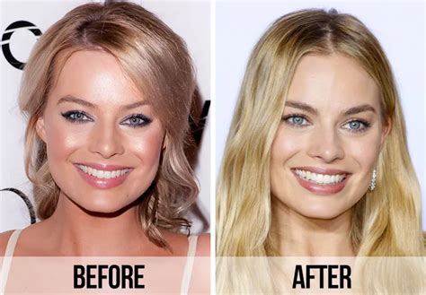 margot robbie before and after surgery|Margot Robbie, Before and After